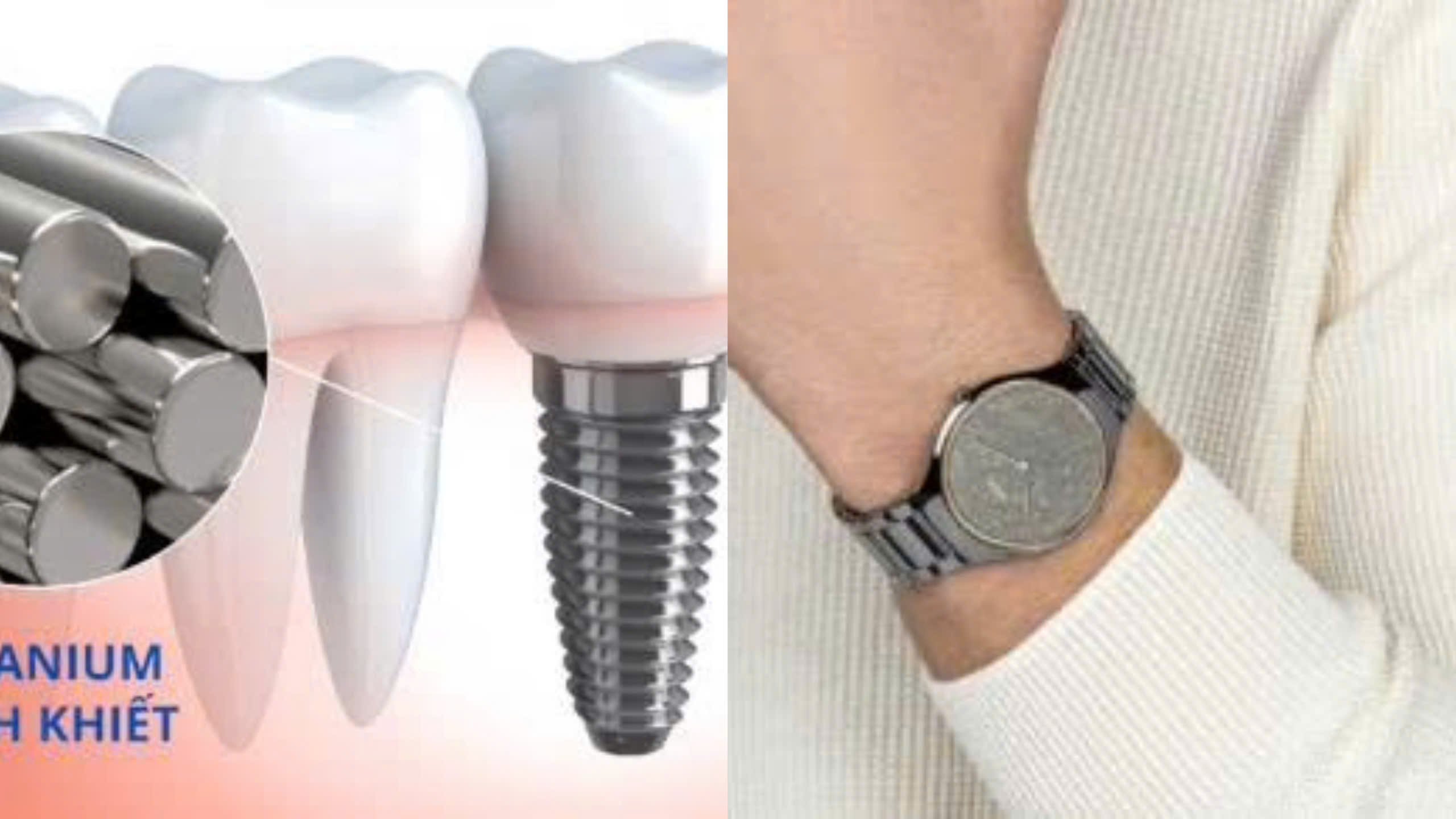Ứng dụng của titanium